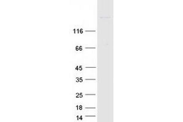 NUP210 Protein (Myc-DYKDDDDK Tag)