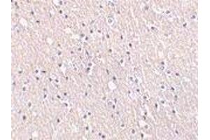 Immunohistochemical staining of CIDE-A in human brain tissue with CIDE-A antibody at 5μg/ml. (CIDEA Antikörper  (AA 200-217))