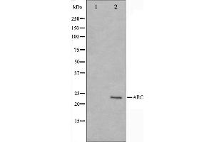 Western blot analysis on HeLa cell lysate using ARC Antibody,The lane on the left is treated with the antigen-specific peptide. (NOL3 Antikörper  (C-Term))