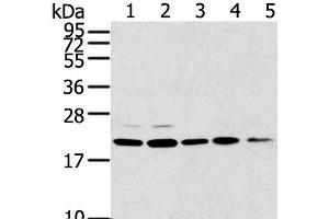 Western Blot analysis of 293T, 231, PC3, A549 and K562 cell using TPD52L1 Polyclonal Antibody at dilution of 1:300 (TPD52L1 Antikörper)