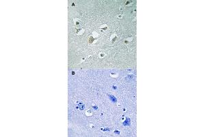 Immunohistochemical staining of human brain tissue by MAP3K9/MAP3K10 (phospho T312/266) polyclonal antibody  without blocking peptide (A) or preincubated with blocking peptide (B) under 1:50-1:100 dilution. (MAP3K9 Antikörper  (pThr266, pThr312))