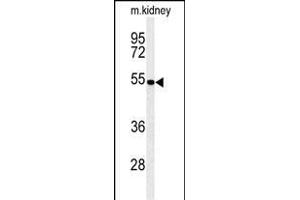 Western blot analysis of PCB Antibody (N-term) (ABIN651181 and ABIN2840115) in mouse kidney tissue lysates (35 μg/lane). (PMPCB Antikörper  (N-Term))