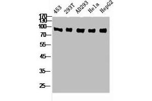 Western Blot analysis of 453 293T AD293 HELA HepG2 cells using Rsk-4 Polyclonal Antibody (RPS6KA6 Antikörper  (C-Term))
