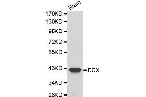 Western Blotting (WB) image for anti-Doublecortin (DCX) (AA 11-360) antibody (ABIN3021510) (Doublecortin Antikörper  (AA 11-360))