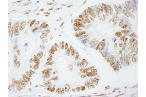 Immunohistochemistry (IHC) image for anti-Splicing Factor Proline/glutamine-Ric (SFPQ) (AA 657-707) antibody (ABIN7449003) (SFPQ Antikörper  (AA 657-707))