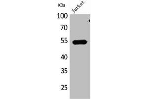 Western Blot analysis of Jurkat cells using DPP7 Polyclonal Antibody (DPP7 Antikörper  (C-Term))