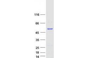 Validation with Western Blot