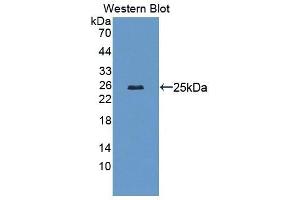 Detection of Recombinant LAMb2, Mouse using Polyclonal Antibody to Laminin Beta 2 (LAMb2) (LAMB2 Antikörper  (AA 1498-1716))