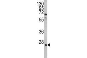 Western blot analysis of GRB2 antibody and A2058 lysate. (GRB2 Antikörper  (AA 89-118))