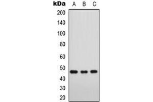 Western blot analysis of FOXD3 expression in Jurkat (A), K562 (B), NIH3T3 (C) whole cell lysates.