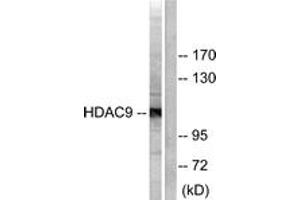 Western blot analysis of extracts from HepG2 cells, using HDAC9 Antibody.