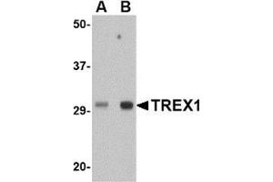 Western blot analysis of TREX1 in human spleen tissue lysate with this product at (A) 0.