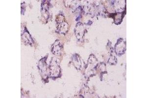 Immunohistochemistry of paraffin-embedded human placenta tissue using ABIN7176944 at dilution of 1:20 (Angiopoietin 2 Antikörper  (AA 19-483))