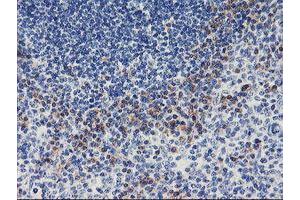 Immunohistochemical staining of paraffin-embedded Human tonsil using anti-ALG2 mouse monoclonal antibody. (ALG2 Antikörper)