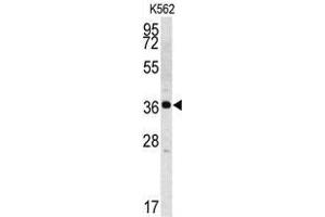 Western blot analysis of Kallikrein 2 (KLK2) Antibody (C-term) in K562 cell line lysates (35ug/lane).