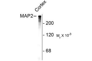 Image no. 1 for anti-Microtubule-Associated Protein 2 (MAP2) antibody (ABIN372661)
