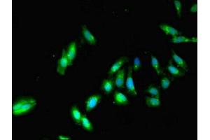 Immunofluorescence (IF) image for anti-Protein Phosphatase 2, Catalytic Subunit, beta Isozyme (PPP2CB) (AA 1-309), (Catalytic Subunit beta) antibody (ABIN7169270)
