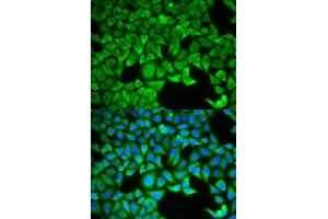 Immunofluorescence (IF) image for anti-Solute Carrier Family 3 Member 1 (SLC3A1) antibody (ABIN1876686) (SLC3A1 Antikörper)