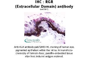 Image no. 1 for anti-Retinal G Protein Coupled Receptor (RGR) (2nd Extracellular Domain) antibody (ABIN1738847) (RGR Antikörper  (2nd Extracellular Domain))