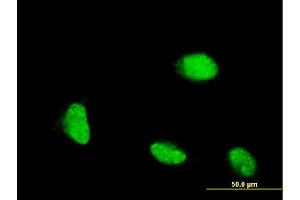 Immunofluorescence of monoclonal antibody to CSRP1 on HeLa cell.