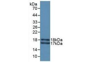 Detection of Recombinant CEACAM1, Rat using Polyclonal Antibody to Carcinoembryonic Antigen Related Cell Adhesion Molecule 1 (CEACAM1) (CEACAM1 Antikörper  (AA 36-145))