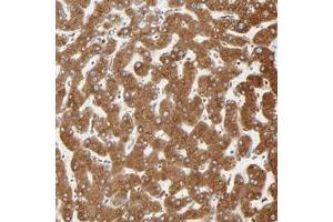 Immunohistochemical staining of human liver with MAGEB17 polyclonal antibody  shows strong cytoplasmic positivity in hepatocyte at 1:50-1:200 dilution. (MAGEB17 Antikörper)