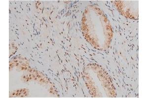 Immunohistochemistry (IHC) image for anti-Jun D Proto-Oncogene (JUND) (pSer255) antibody (ABIN6255135)