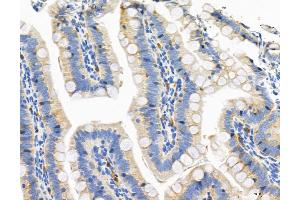 ABIN6266329 and ABIN6276659 at 1/100 staining Rat colon tissue by IHC-P. (CD44 Antikörper  (Internal Region))
