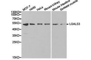 Western Blotting (WB) image for anti-Galectin 3 (LGALS3) antibody (ABIN1873541) (Galectin 3 Antikörper)