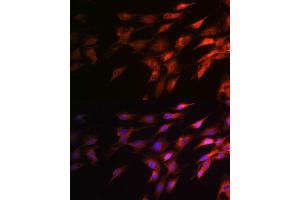 Immunofluorescence analysis of C6 cells using Neurofilament H Rabbit pAb (ABIN6129638, ABIN6144512, ABIN6144513 and ABIN6224502) at dilution of 1:100 (40x lens). (NEFH Antikörper  (AA 821-1020))