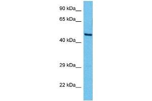 Host:  Mouse  Target Name:  YY1  Sample Tissue:  Mouse Brain  Antibody Dilution:  1ug/ml (YY1 Antikörper  (Middle Region))