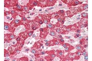 Human Liver (formalin-fixed, paraffin-embedded) stained with CTSDat 10 µg/ml followed by biotinylated goat anti-rabbit IgG secondary antibody, alkaline phosphatase-streptavidin and chromogen. (Cathepsin D Antikörper)