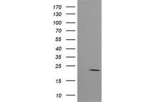 Image no. 2 for anti-HRas proto-oncogene, GTPase (HRAS) antibody (ABIN1498716) (HRAS Antikörper)