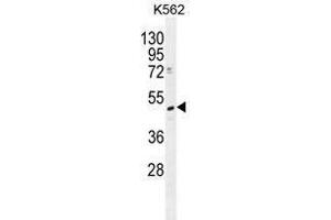 TRMT2B Antibody (N-term) western blot analysis in K562 cell line lysates (35 µg/lane).