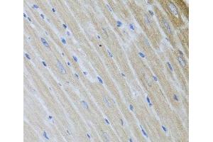 Immunohistochemistry of paraffin-embedded Mouse heart using USP25 Polyclonal Antibody at dilution of 1:100 (40x lens). (USP25 Antikörper)