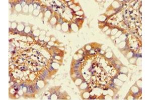 Immunohistochemistry of paraffin-embedded human small intestine tissue using ABIN7143191 at dilution of 1:100 (ACAD9 Antikörper  (AA 1-270))