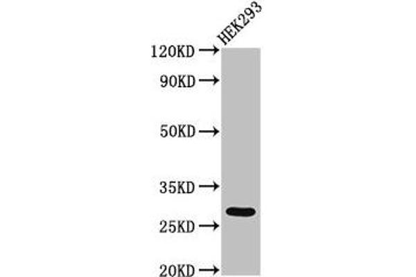 ANKRD49 Antikörper  (AA 4-239)
