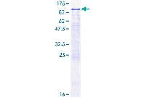 RHOT2 Protein (AA 1-618) (GST tag)