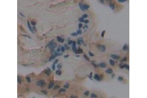 Used in DAB staining on fromalin fixed paraffin- embedded lung tissue (FADS3 Antikörper  (AA 331-445))