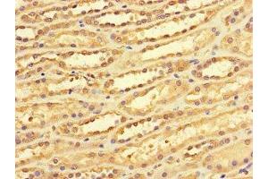 Immunohistochemistry of paraffin-embedded human kidney tissue using ABIN7149476 at dilution of 1:100 (DACH1 Antikörper  (AA 166-369))