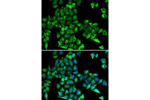 Immunofluorescence analysis of HeLa cells using CST3 antibody. (CST3 Antikörper)