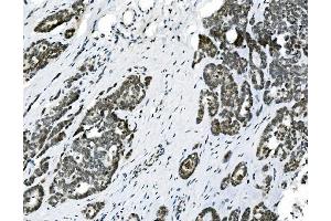 IHC analysis of HOXD11 using anti-HOXD11 antibody (ABIN7603174). (HOXD11 Antikörper  (N-Term))