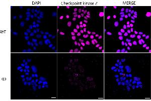Immunocytochemical staining of Hela cells using Checkpoint kinase 2 antibody (ABIN7798040), 1:1,000), Top panel: wild-type (WT), Bottom panal: Checkpoint kinase 2 shRNA knockdown (KD). (Rekombinanter CHEK2 Antikörper)