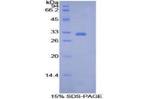 SDS-PAGE (SDS) image for Pyruvate Dehydrogenase Kinase, Isozyme 4 (PDK4) (AA 73-316) protein (His tag) (ABIN2126592)