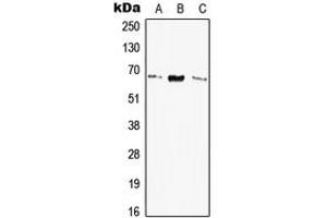 Western blot analysis of Elastin expression in HEK293T (A), SP2/0 (B), H9C2 (C) whole cell lysates. (Elastin Antikörper  (Center))