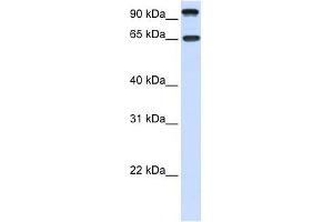 NTRK3 antibody used at 1 ug/ml to detect target protein.