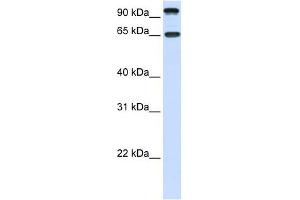 NTRK3 antibody used at 1 ug/ml to detect target protein. (NTRK3 Antikörper  (C-Term))