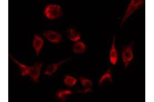 ABIN6274544 staining Hela by IF/ICC. (STAG3 Antikörper  (C-Term))