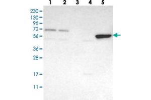 Western blot analysis of Lane 1: RT-4, Lane 2: U-251 MG, Lane 3: Human Plasma, Lane 4: Liver, Lane 5: Tonsil with FAM73A polyclonal antibody  at 1:250-1:500 dilution. (FAM73A Antikörper)