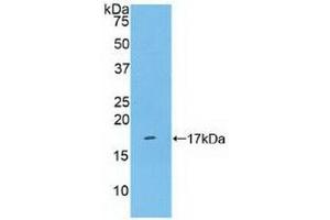 Detection of Recombinant KLRB1, Human using Polyclonal Antibody to Cluster Of Differentiation 161 (CD161) (CD161 Antikörper  (AA 73-188))
